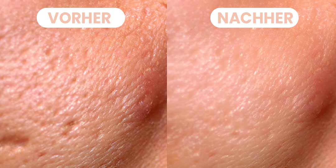 Ultrasonic Facescrub (13) Ultrasonic Facescrub (13)